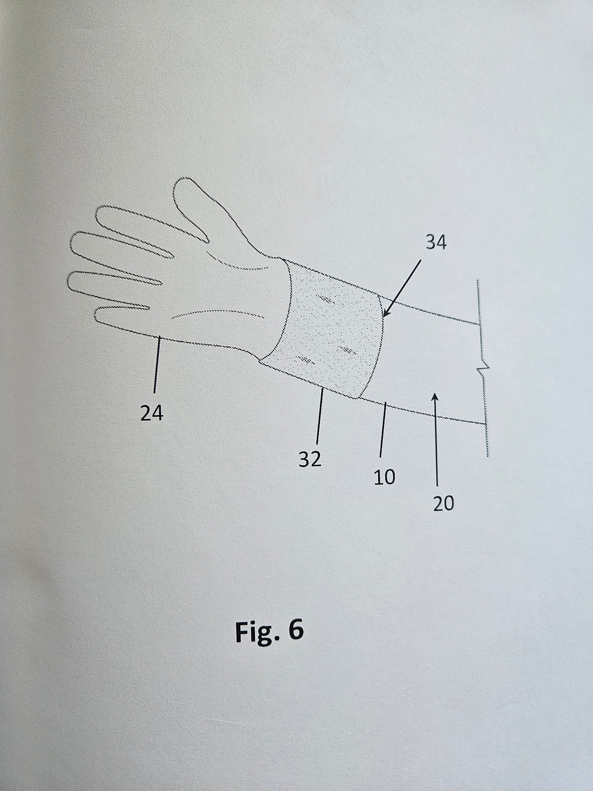 Figure 6 of U.S. Patent 11,589,626 B2 showing the glove donned on the hand while attached to the sleeve